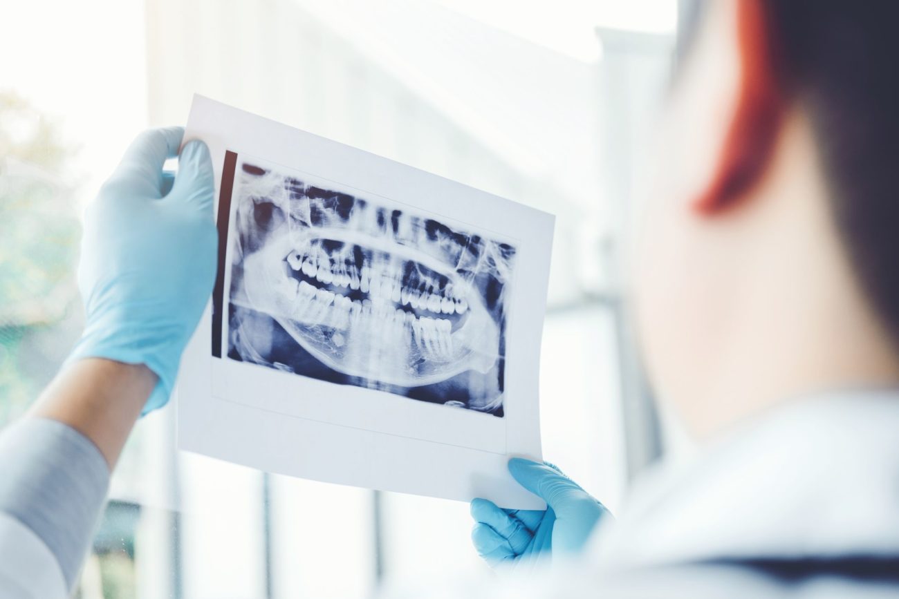 routine dental x-rays with preventative dentistry